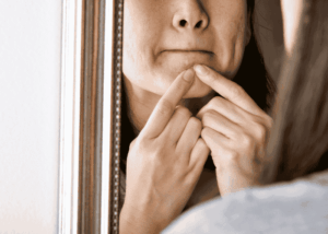 Skin Picking in Teens | Causes, Signs, and Coping Strategies