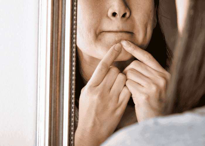 teenage girl who struggles with skin picking in teens standing in front of a mirror squeezing a pimple