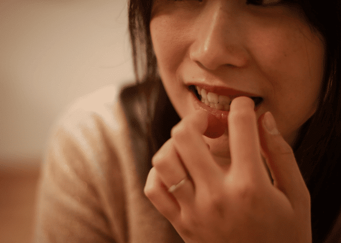 Close up of teen biting nails as sign of fidgeting in teens